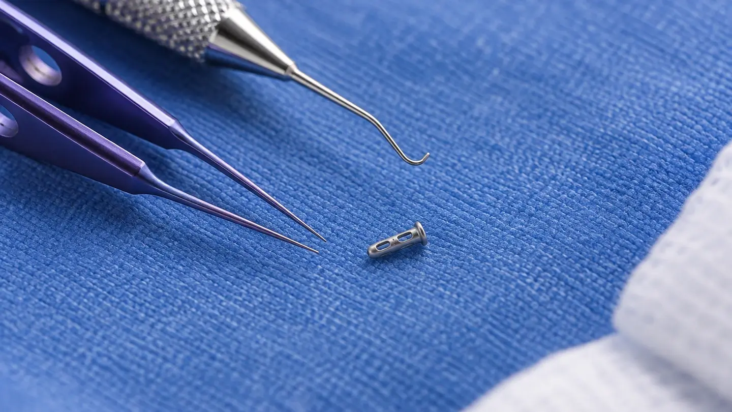 Minimally Invasive Glaucoma Surgery Migs (1)